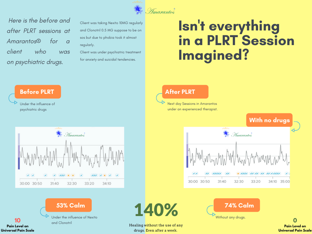 EEG Report of before and After PLR Session in Amarantos